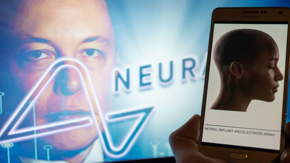 Elon Musk's Mind-Blowing Revelation: The Secret to Curing Depression with a Mysterious Brain Chip