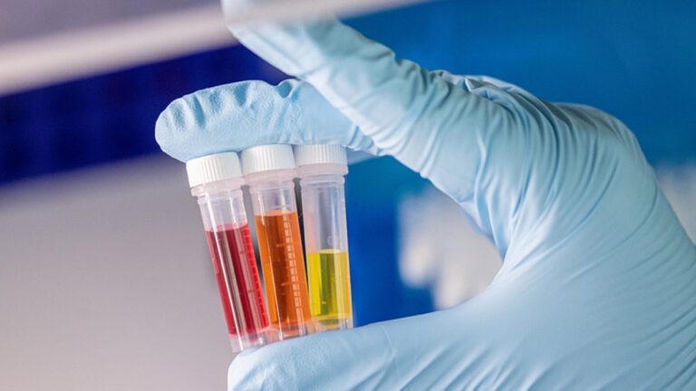 In vitro diagnostics